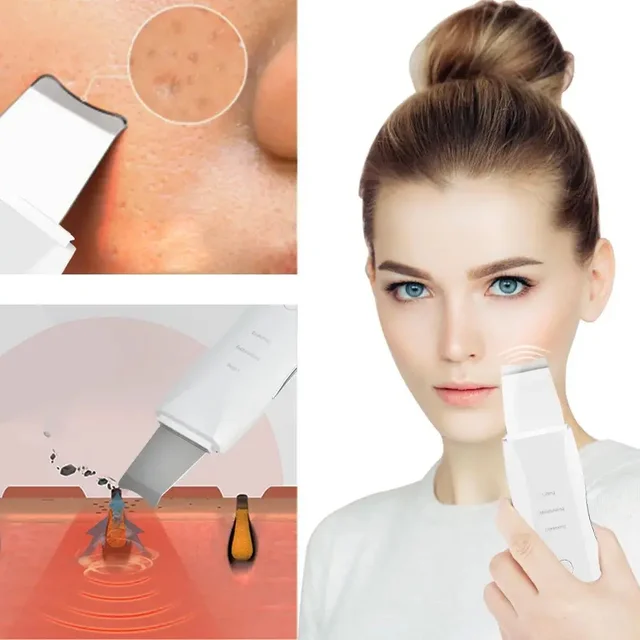 Épurateur de peau à vibrations profondes, nettoyeur facial, spatule non ultrasonique, dissolvant de