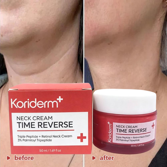 Koriderm+ Time Reversal Neck Tightening Cream Tripeptide Retinol Smooth Double Chin Eliminate Neck Wrinkles Skin Care Cream