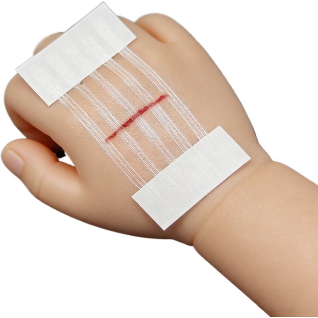 5 Strips Wound Skin Closure Strips Postpartum Wound Repair Cosmetic Surgery Strip Adhesive Medical Suture Free Surgical Tape