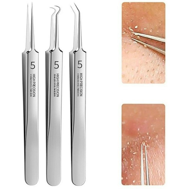 Precision Pimple Comedone Extractor Clip Tool 1/3Pcs Extra Fine No.5 Cellular Blackhead Tweezers Facial Acne Remover Needle Tool