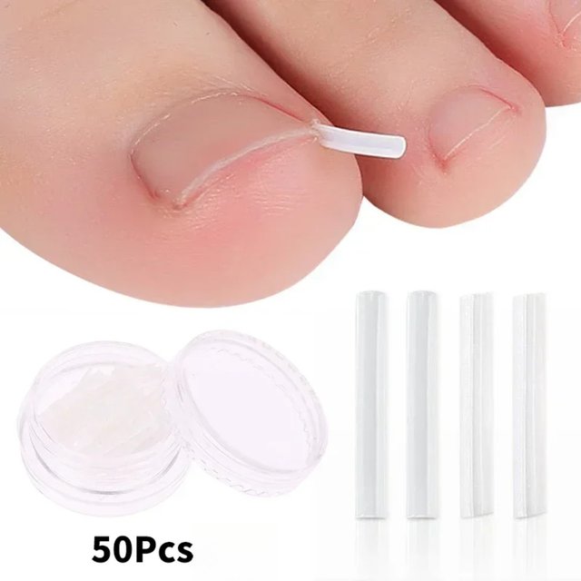 50Pcs Curved Toenail Care Tool Elastic Nail Patch Sticker Shaping Clip Foot Pedicure Tool