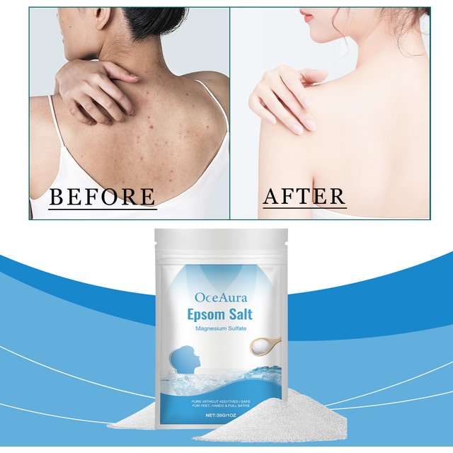 Epsom Salt Magnesium Sulfate Moisturizing Exfoliating Pure Natural Feet Hands Bath Body Relaxation Muscle Relief Detox Skin Care