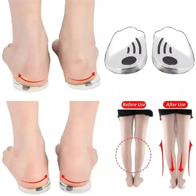 Silicone Orthopedic Insoles for Feet O/X Leg Type Valgus Varus Correction Plantar Fasciitis Gel Insole Magnet Massage Foot Care