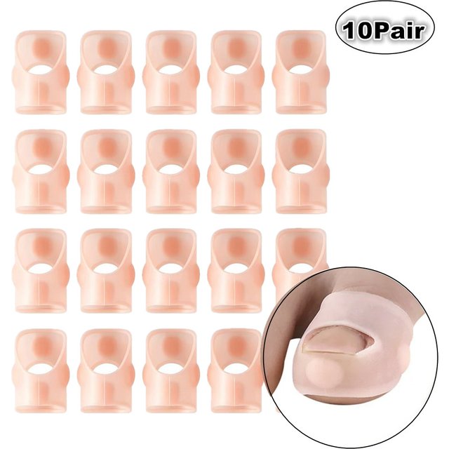 10Pair Toe Separator Pedicure Correction Tool - Toenail Protector Straightening Clip Brace for Foot Care Paronychia Treatment