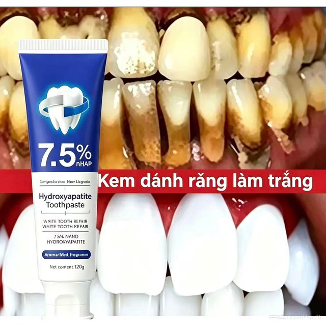 Toothpaste with 7.5% Nanohydroxyapatite to Remove Coffee and Tea Sms, Improve Bad Breath, Prevent Caries and Clarify Teeth