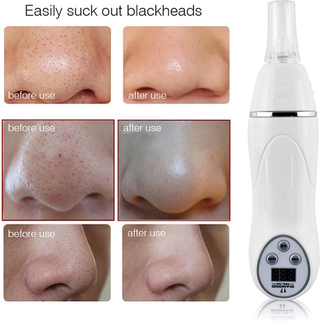 2026 Diamond Microdermabrasion Beauty Device Facial Deep Cleansing Pore Cleaner Handheld Blackhead Removal Skin Care