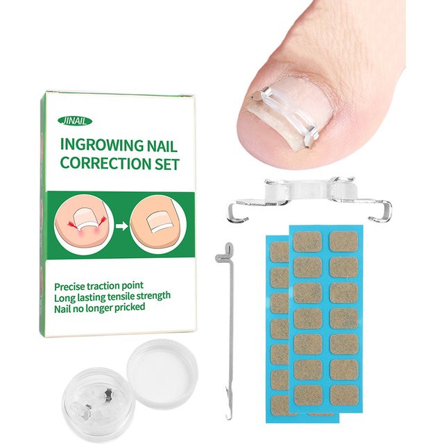 1/2Set Ingrown Toenail Corrector Tools Pedicure Recover Embed Toenail Treatment Professional Foot Care Correction Tool