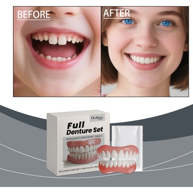 Oralhoe Dental Prosthetic Enhancement Kit for Enhanced Smile Aesthetics and Comfort with Cosmetic Denture Materials