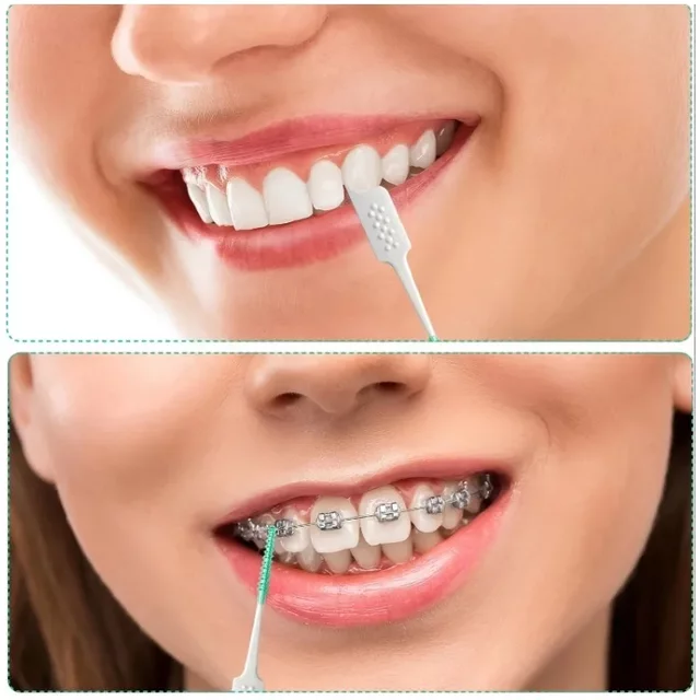 40/200 Soft Glue Interdental Brush, Straight Interdental Brush, Orthodontic Correction Interdental Brush, Disposable Toothbrush