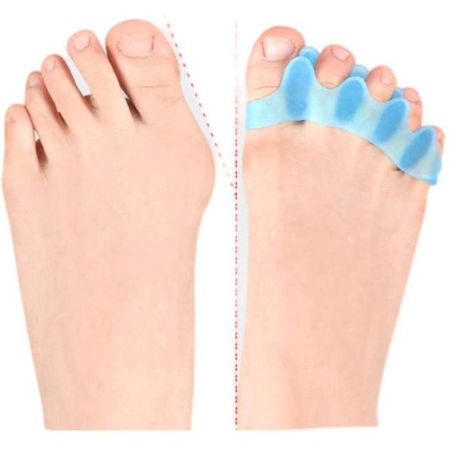 2Pcs=1Pair Silicone Toe Separator Bunion Corrector Hammer Toe Corrector Soft Silicone Material for Toe Separation Foot Care Tool