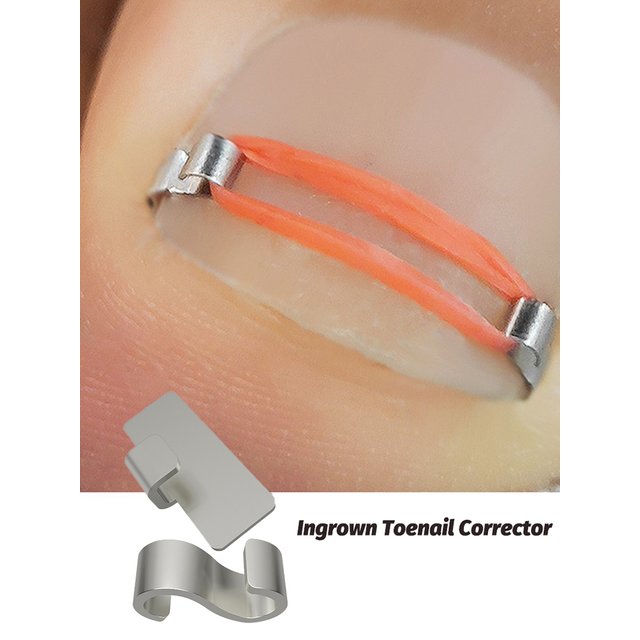 1/2pc Ingrown Toenail Corrector Pedicure Recover Embed Toe Nail Treatment Professional Ingrown Toenail Correction Foot Care Tool