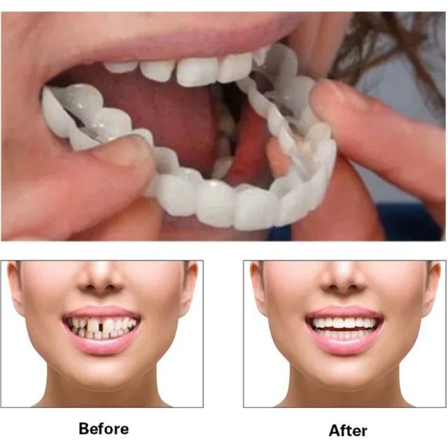 Perfect Fit Teeth Whitening Fake Tooth Cover Snap on Silicone Smile Veneers Teeth Flexibles Fake Teeth Dental Whitening Devices