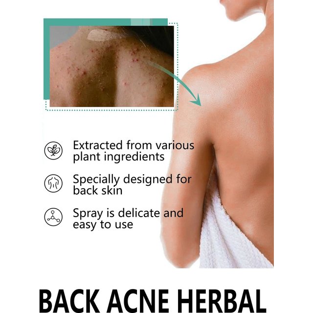 Herbal Acne Remover Spray Back Shoulder Pimple Treatment Blackhead Anti Mites Oil Control Repair Smooth Skin Care Beauty Health