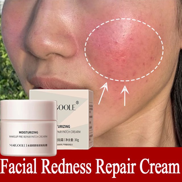 Facial Redness Reduce Cream Improve Sensitive Skin Dryness Moisturizer Hydrating Sooth Lotion Fade Rosacea Korean Cosmetics