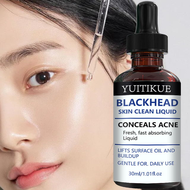 YUITIKUE Blackhead Remover Liquid Gentle Acne Oil Control Deep Cleansing Pore Refining Skin Care