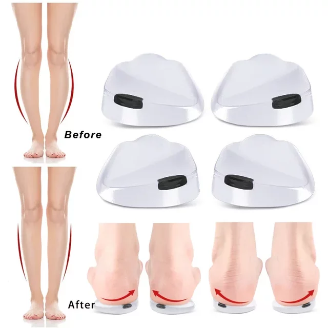 Orthopedic Gel Insoles Magnet Massage Foot Care Silicone O/X Leg Type Valgus Varus Correction for Plantar Fasciitis Shoe Inserts