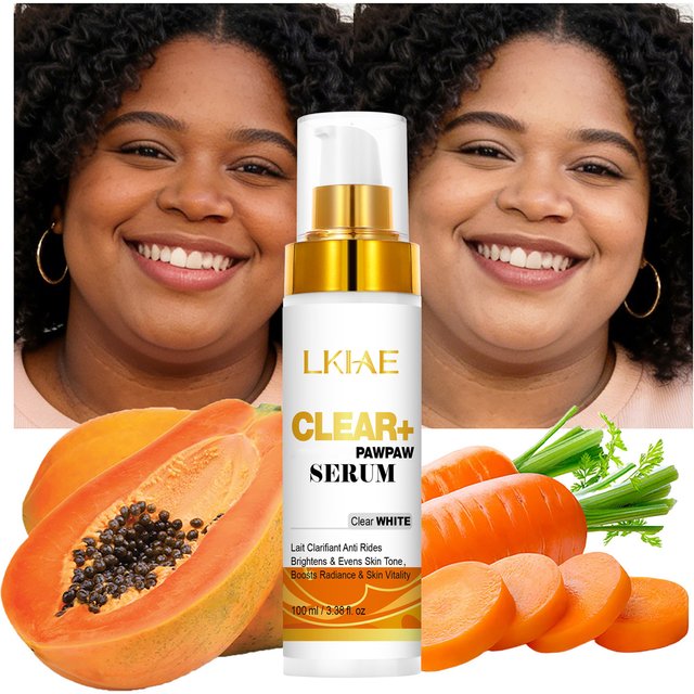 AILKE Dark Spot Corrector PLUS Cream, Organic Dark Spot Correction Facial Cream, Remove Stains, Age Spots, Sun Spots