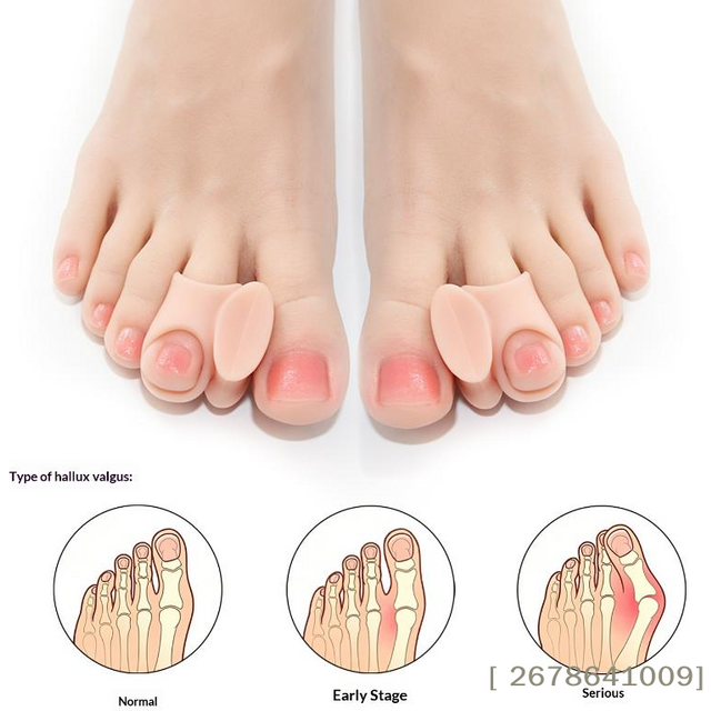 ⚑1 Pairs Silicone Toe Separator Bunion Bone Ectropion Adjuster Toes Outer Appliance Foot Care Tool Hallux Valgus Corrector
