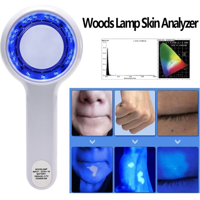 NEW Woods Lamp Skin Analyzer Portable Facial Salon Beauty Analyzer UV Lamp Wood Dermatology for Analyzing Testing Examination
