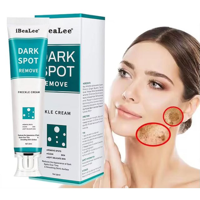 Melasma Brightening Face Cream Niacinamide Serum Brighten Cream Fade Fine Lines Lighten Dark Dot Reduce Melanin Face Skincare