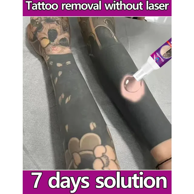 Tattoo Removal Spray Pigmented Permanent Makeup Tattoo Removal