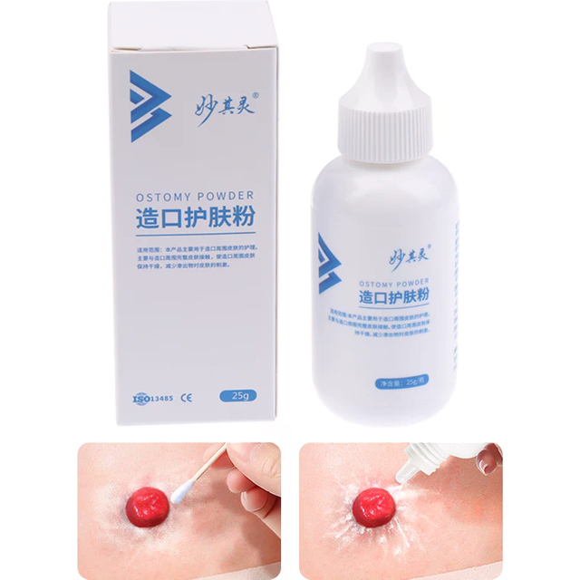 25g Skin Care Flour Dry Flour Stoma Treatment Medical For Tool Ostomy Accessory Colostomy Bag Care Products