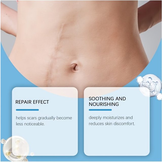 A Box of Invisible Silicone Scar Masking Sticker, Suitable for Scars and Tattoos, Light Beige Concealer Sticker
