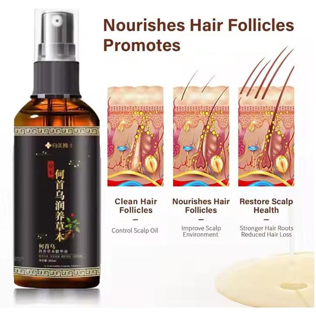 Hair Loss Solution Hair Growth Serum Spray for men And Women,Hair Serum Polygonum Multiflori Radix, Ginger,Hair Care Essence Oil