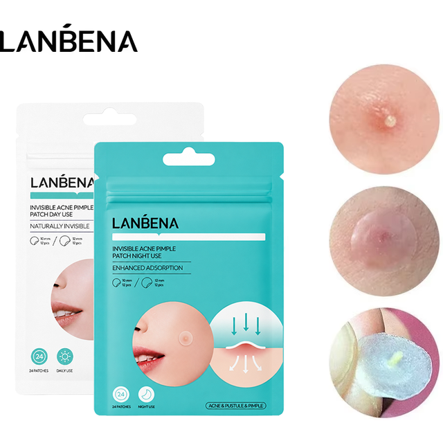 LANBENA Repair Acne Patch Facial Skin Care Fade Blemishes Pimple Marks Closed Acne Blemishes Cover Acne Pimple Repair Patch