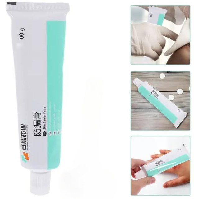 Wholesale Skin Care Powder Stoma Accessories After Surgery Cream Tool Barrier Paste Leak-proof for Ostomy Bag Anti Ointment