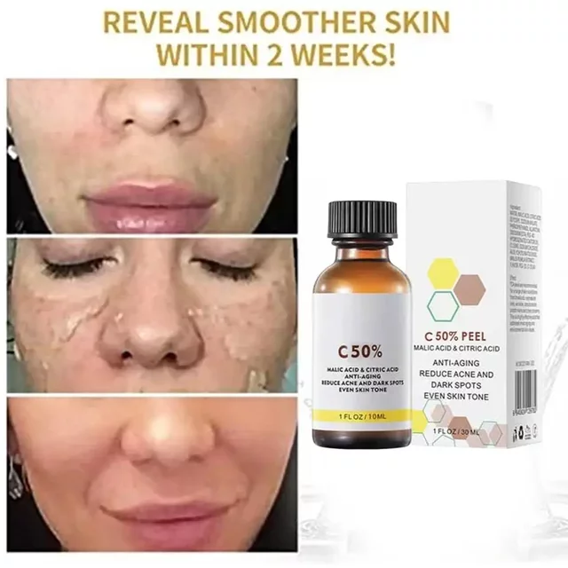 Salicylic Acid Face Facial Peel Neutraliser Face Deep At Home Chemical Peel Exfoliate Refine skin care serum NEW