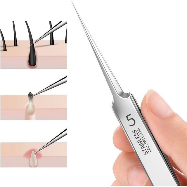 Stainless Steel Blackhead Removal Tweezers - Facial Tool For Removing Blackheads And Whiteheads, Deep Cleansing.