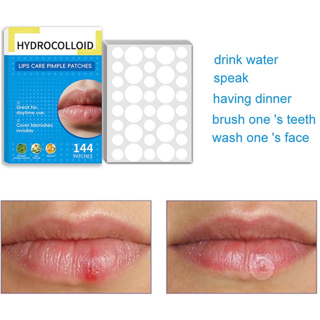 144Pcs Mouth Blister Patch Cold Sore Lip Blister Patch Cold Sore Healing Hydrocolloid Lip Care Stickers Mouth Blister Patch