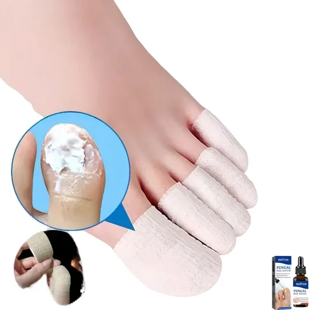 Fungal nail polish, nail coating, toe protection, foot and finger protection, self-adhesive bandage, toe and finger protection