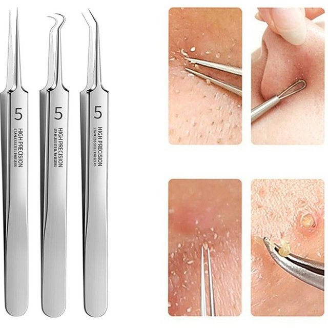 Precision Pimple Comedone Extractor Clip Tool 1/3Pcs Extra Fine No.5 Cellular Blackhead Tweezers Facial Acne Remover Needle Tool