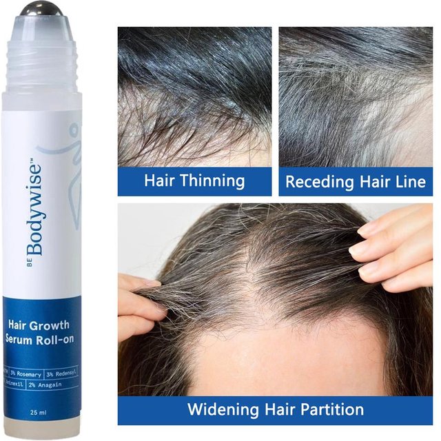25ml 3% Rosemary Hair Growth Serum - Deep Scalp Nourishment Frizz Control Strengthen Hair Roots Hair Care Essence Oil