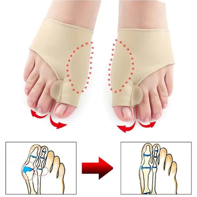 1Pair Orthopedic Toe Separator Hallux Valgus Bunion Corrector Hammer Toe Straightener Foot Pain Relief Pedicure Foot Care Tool