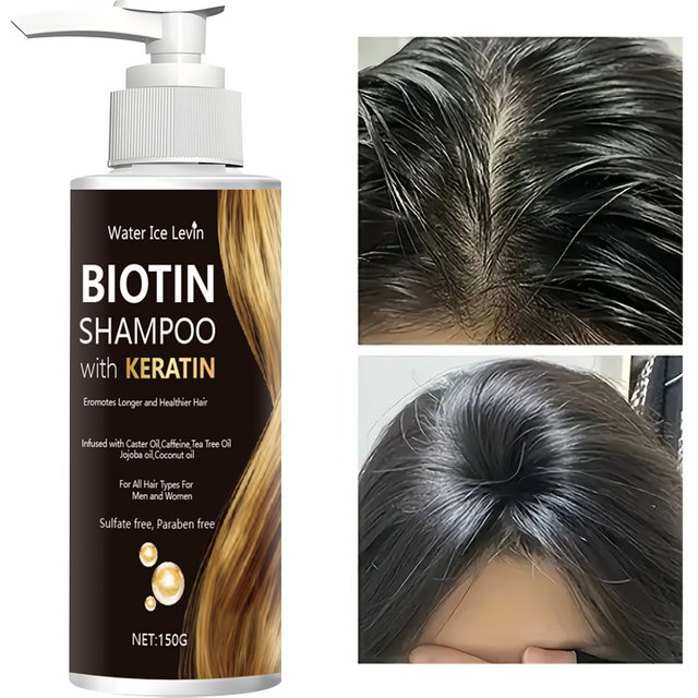 Water Ice Levin Biotin & Keratin Shampoo, Sulfate/Paraben Free, With Nourishing Oils, For Longer Healthier Hair, All Hair Types