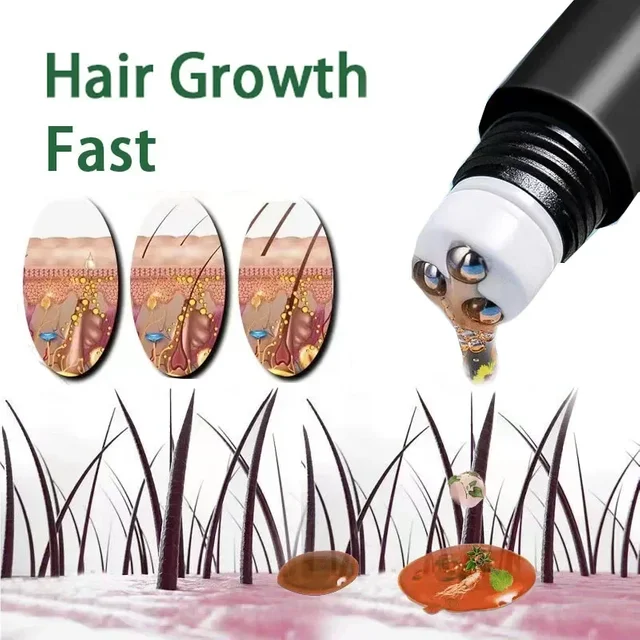 Huile de croissance rapide des cheveux à la biotine, produits de soin, traitements de massage du cuir chevelu, anti-chute de cheveux, sérum efficace pour faire pousser des cheveux plus épais pour les