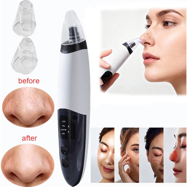 Electric Blackhead Remover Pore Vacuum Cleaning Extractor Portable Acne Blackhead Removal Rechargeable Facial Black Dots Remover