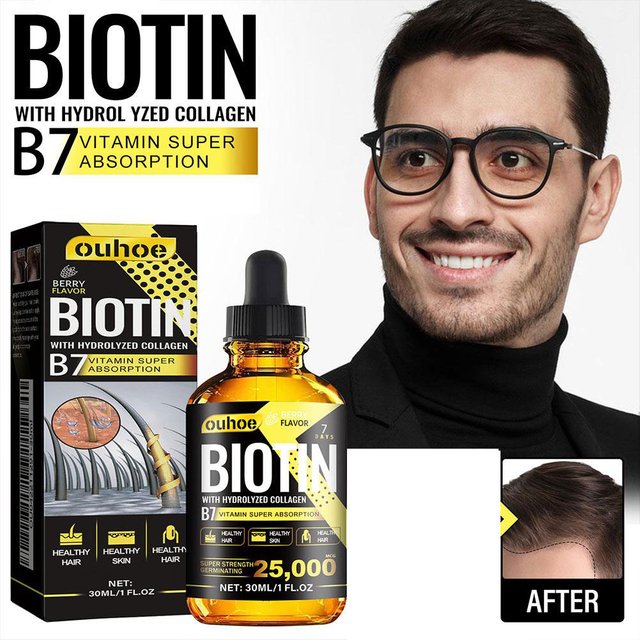 L'huile de croissance des cheveux infusée à la biotine prévient la perte de cheveux et nourrit avec des huiles essentielles traitement du cuir chevelu Spray beauté santé soins capillaires