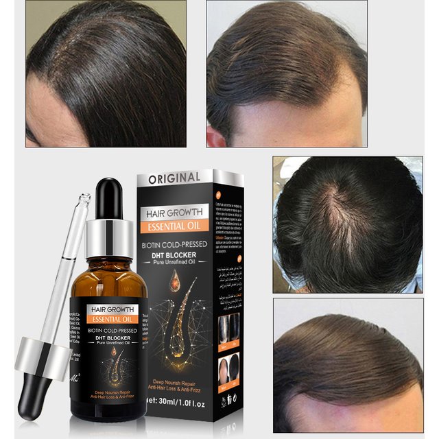 wash Ginger scalp free hair care massage essential Hair growth oil