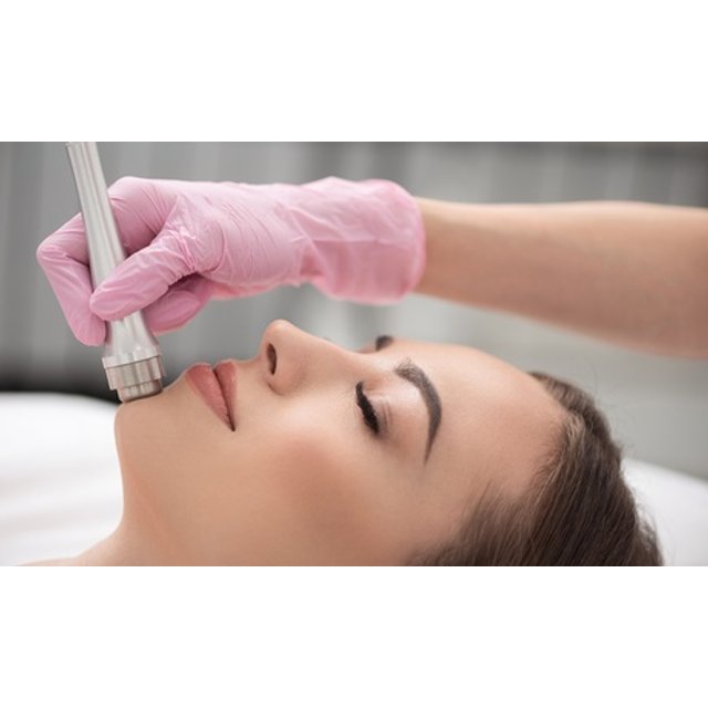 Limpieza facial completa con dermoabrasión con punta de diamante