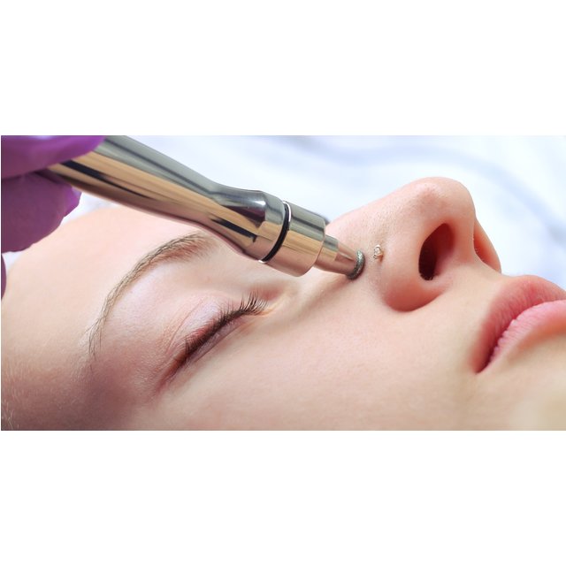 Basic Facial, Diamant Mikrodermabrasion oder Hydrogenbehandlung