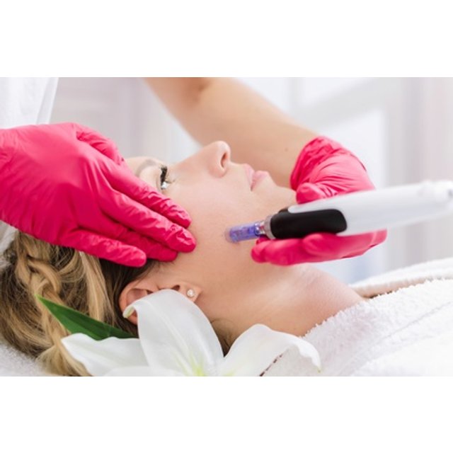 1 sesión de microlifting facial de vitaminas con dermapen