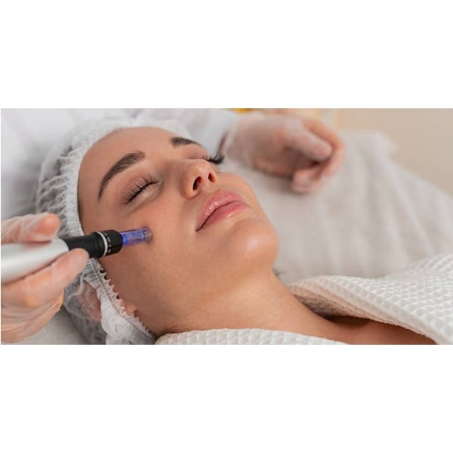 Tratamiento facial con Dermapen, mascarilla y opción a extras para 1