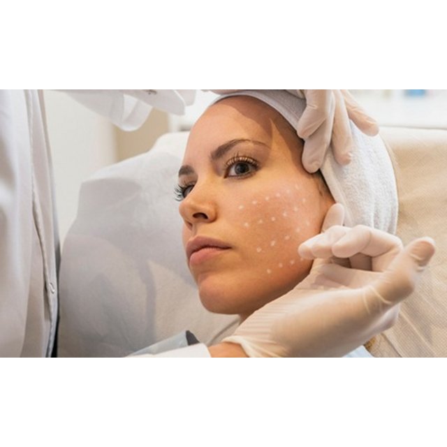 Tratamiento facial: Tratamiento reafirmante inyectado / Frente