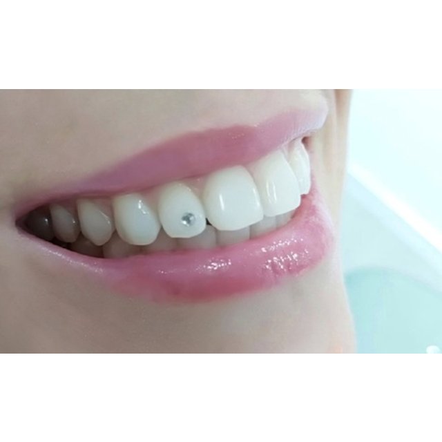 Limpieza dental con ultrasonidos con un piercing dental