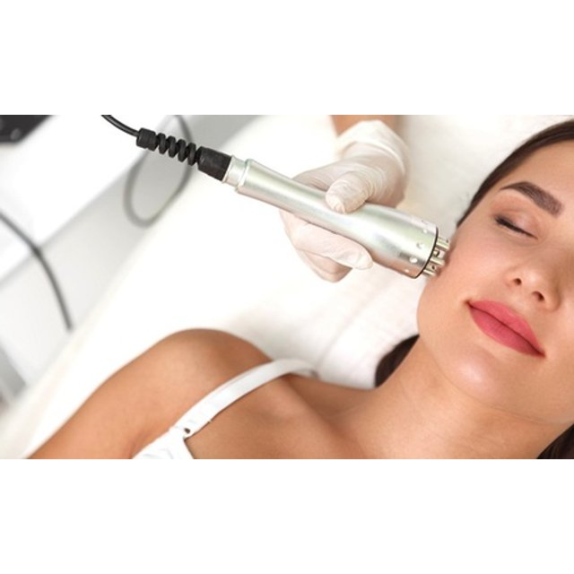 1 sesión de radiofrecuencia facial o corporal
