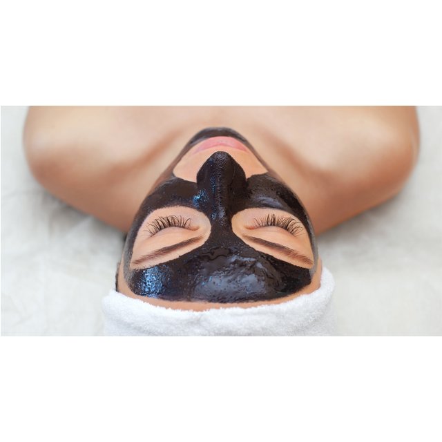 Carbon Laser Peel